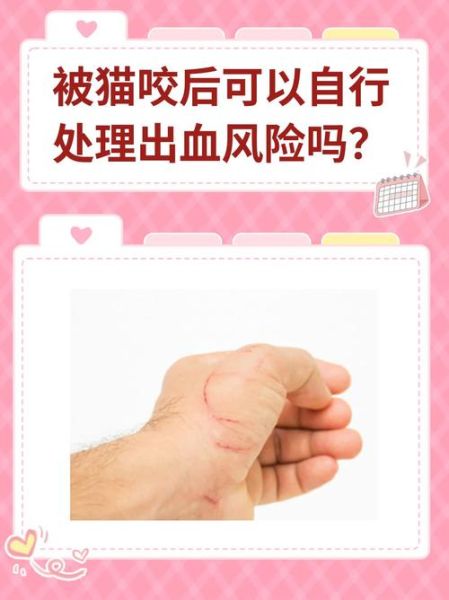 梦到被猫咬是什么意思_被猫咬出血预示什么