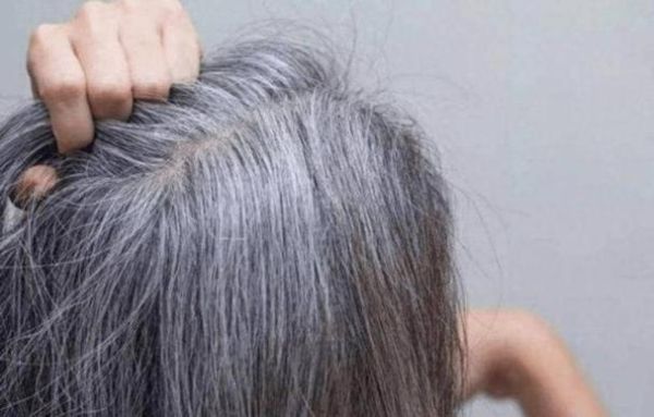 梦到头发白了_是什么预兆