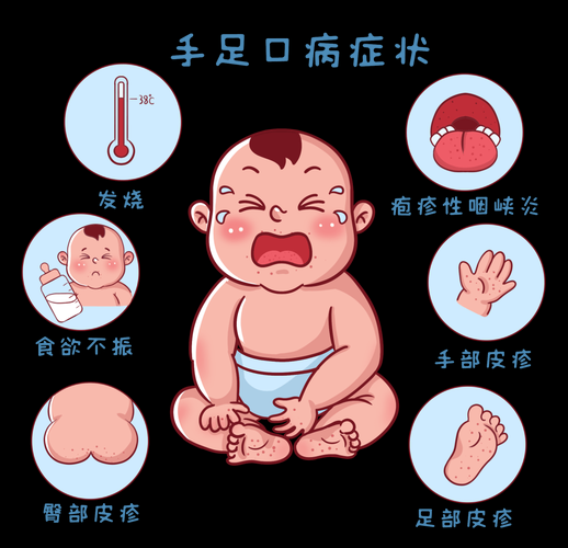 宝宝手足口病痒怎么办_手足口病止痒方法