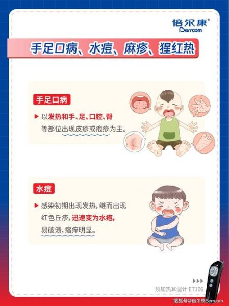 宝宝手足口病痒怎么办_手足口病止痒方法