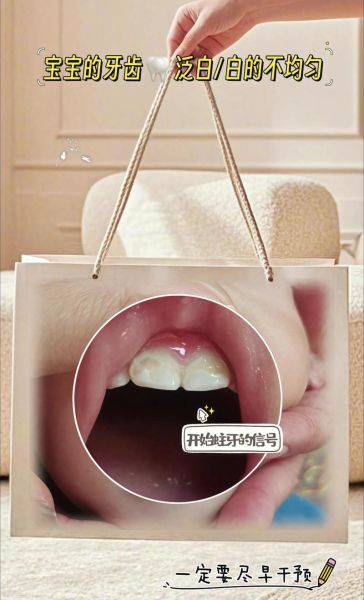 宝宝多大开始刷牙_婴儿第一颗牙怎么清洁