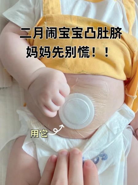 宝宝脐疝怎么处理_宝宝脐疝多久能好