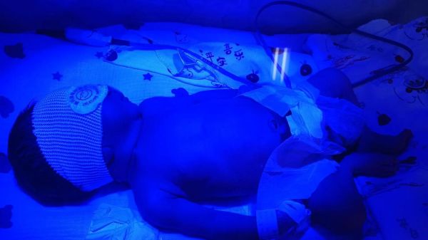 宝宝照蓝光有什么副作用_新生儿黄疸蓝光治疗安全吗