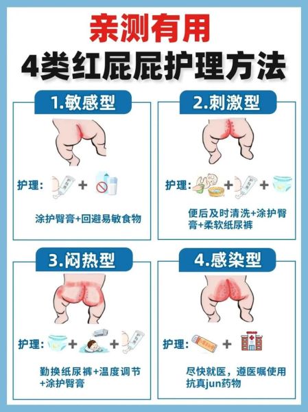 宝宝红屁股怎么处理_红屁股最快最有效的办法