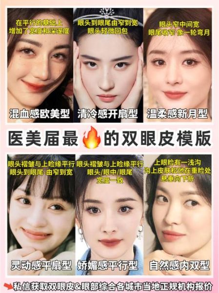 梦到做双眼皮_梦见割双眼皮是什么意思