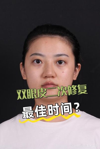 梦到做双眼皮_梦见割双眼皮是什么意思