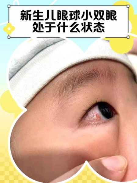 宝宝眼睛往上翻白眼是怎么回事_新生儿翻白眼正常吗