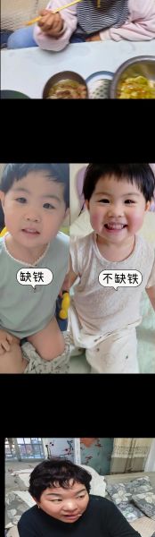 宝宝肝不好有什么症状_新生儿肝功能异常表现