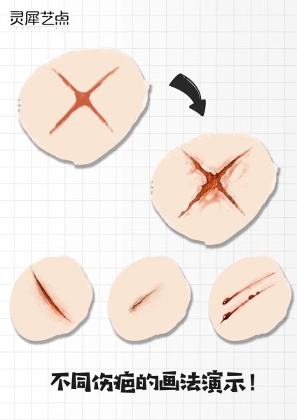 伤痕图片大全_如何分辨新旧伤疤