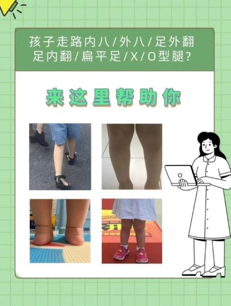 一岁宝宝走路脚往内拐_内八字正常吗