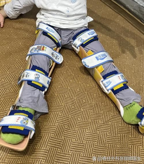 一岁宝宝走路脚往内拐_内八字正常吗