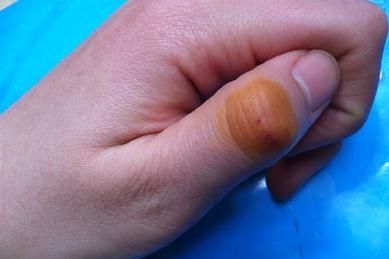 梦到被老鼠咬了是什么意思_周公解梦原版解析