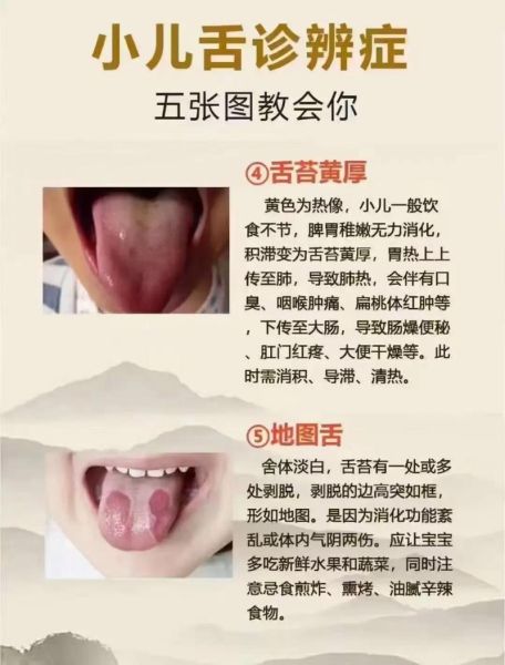 宝宝舌苔厚白怎么调理_婴儿舌苔厚白吃什么好