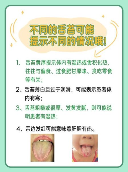 宝宝舌头白色厚厚一层_怎么办