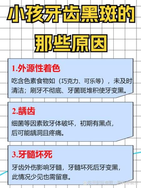 宝宝牙齿发黑怎么办_牙齿色素沉着怎么去除