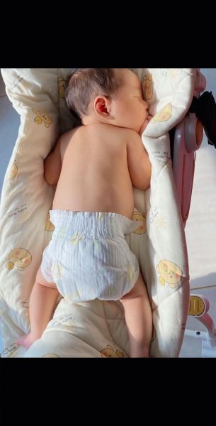 宝宝晒黄疸晒哪个部位_新生儿黄疸晒太阳正确方法