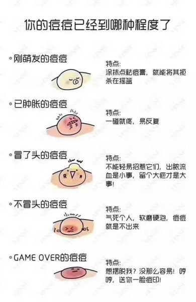 粉刺图片大全_粉刺怎么区分类型