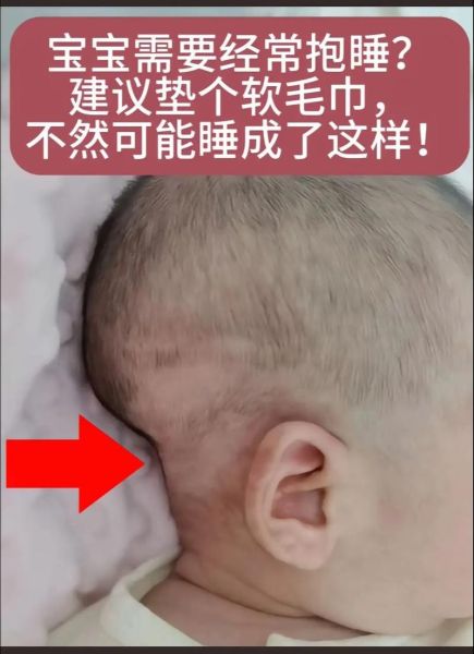 宝宝后脑勺有凹槽正常吗_婴儿头骨凹陷原因