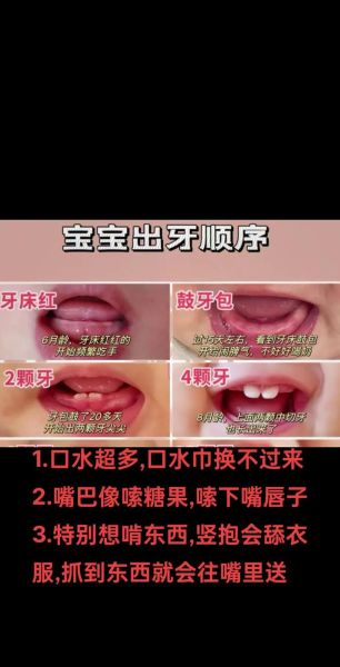 3个多月宝宝长牙正常吗_婴儿最早几个月长牙算正常