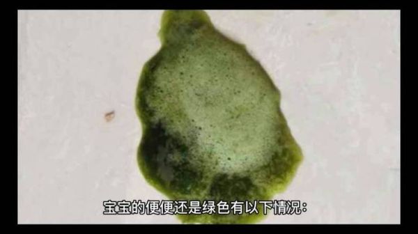 宝宝粑粑绿色有粘液怎么回事_需要看医生吗