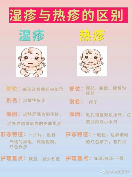 宝宝热疹子图片_热疹和湿疹区别