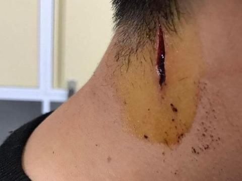 梦到脖子流血_周公解梦原版