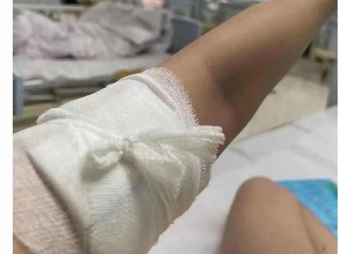 梦到开刀是什么意思_梦见自己开刀手术预示什么