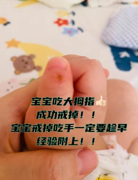 三个月宝宝睡觉吃手正常吗_如何戒掉