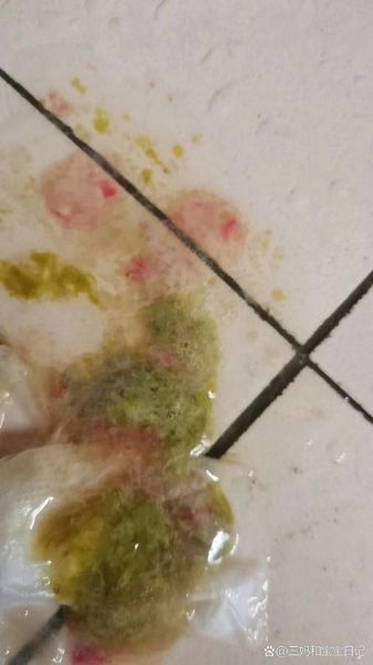 5个月宝宝大便有血丝怎么办_婴儿大便带血原因