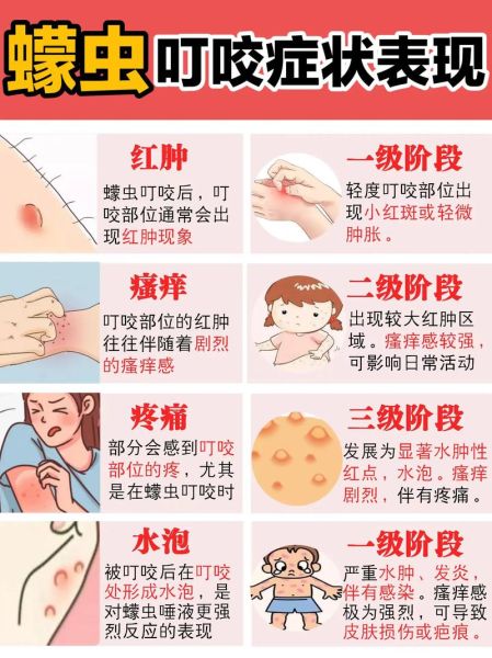 梦到被虫子咬是什么意思_被虫子咬梦境解析