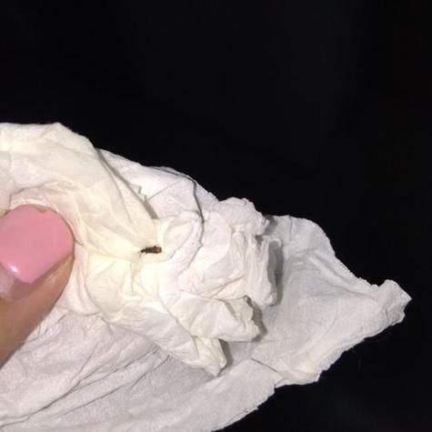 梦到身上有虫子_周公解梦准吗