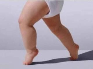 宝宝走路踮脚怎么办_踮脚走路正常吗