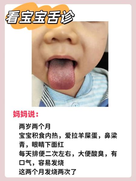 宝宝几个月会吐舌头_吐舌头是正常现象吗