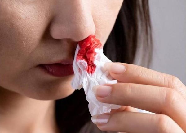 做梦梦到流鼻血_预示什么