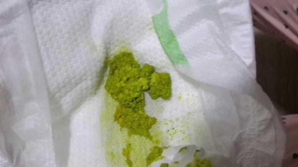 宝宝大便绿色怎么办_新生儿绿便正常吗