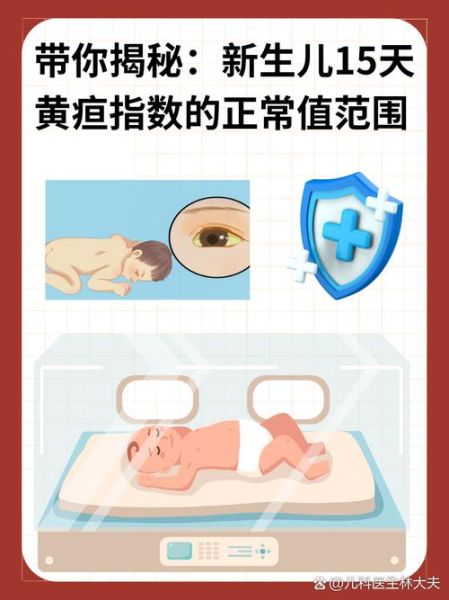宝宝黄疸多久能退_新生儿黄疸正常值是多少