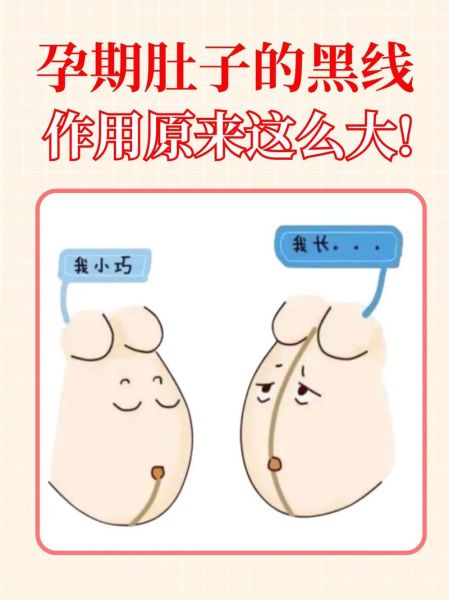 宝宝肚子上有一条竖线怎么回事_新生儿腹线正常吗