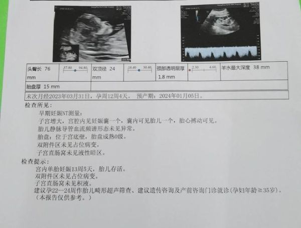 怎样让宝宝很快配合_nt引导技巧