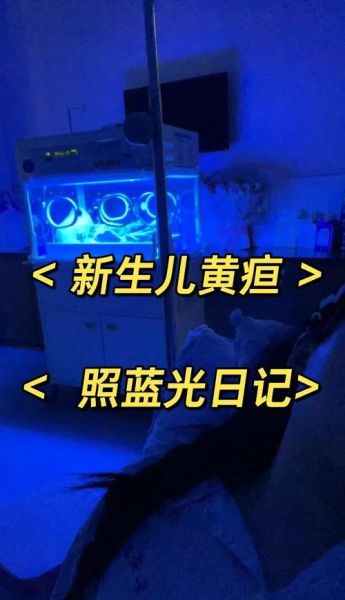 宝宝黄疸23点多怎么办_黄疸23需要照蓝光吗