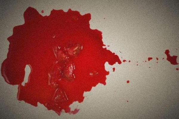 梦到血水是什么意思_梦见血水好不好