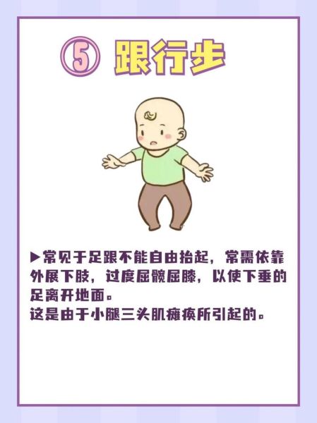 宝宝走路像鸭子正常吗_如何矫正