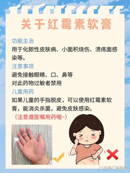 两岁宝宝手指头脱皮怎么回事_怎么办